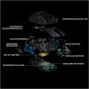 Logitech G Pro Wireless